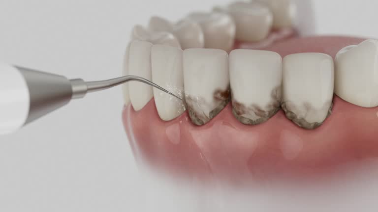 Reliable Tooth Extraction contractor in Las Animas, CO by Smile Center Dentistry